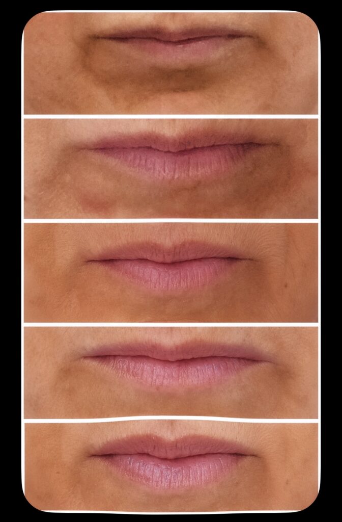 Exion Lips