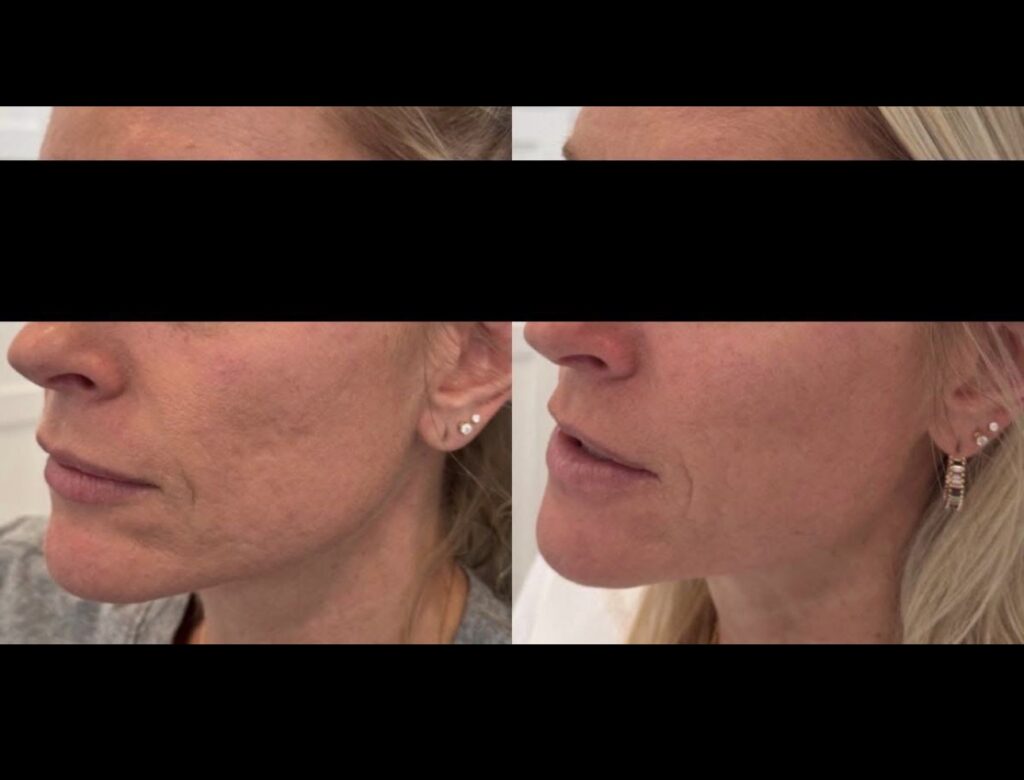 Texture Reset